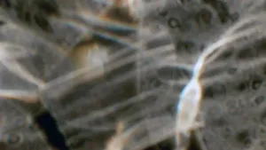 Spleti čar